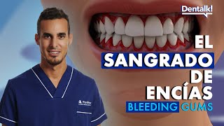 ¿SANGRADO DE ENCÍAS? - Causas, prevención y tratamiento de las encías sangrantes | Dentalk! ©