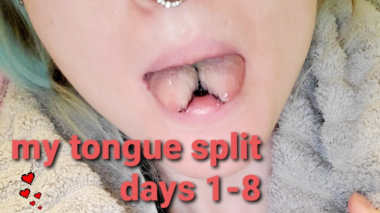 Getting My Tongue Split Days 1 8 Youtube 