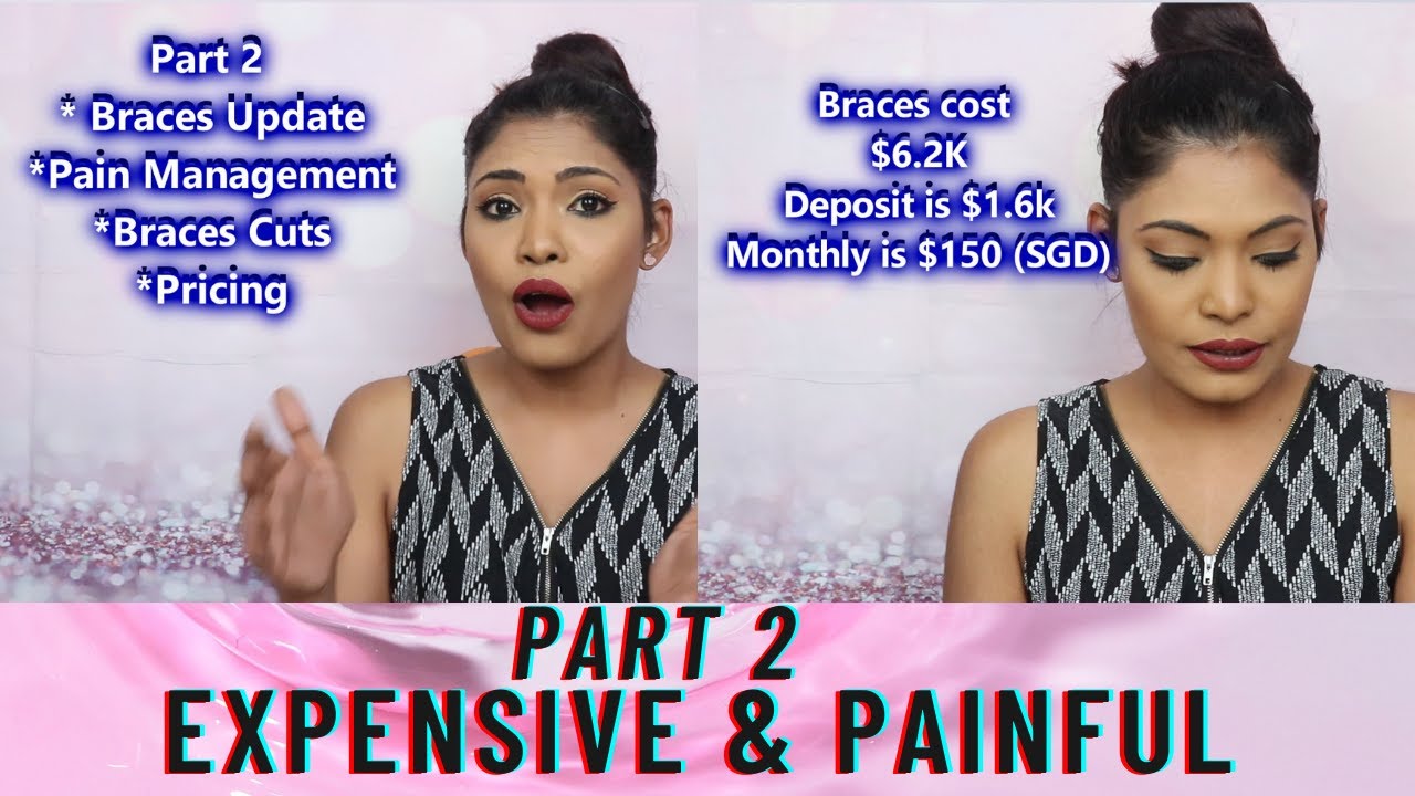 How Braces Are ! Updates, Braces Cuts, Tightening