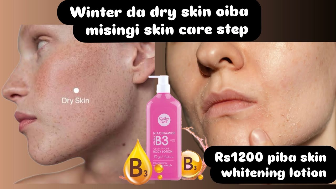 Rs1200 oiba skin ngouthokpi lotion/winter da dry skin oiba migi skin care 