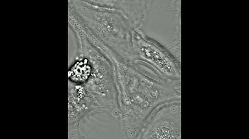 SLIM optical sectioning: 100X magnification z-stack U-2OS cell culture