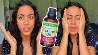 Skincare Benefits + Uses of TEA TREE OIL | HOW TO Remove Acne Scars + Dark Spots Permanently