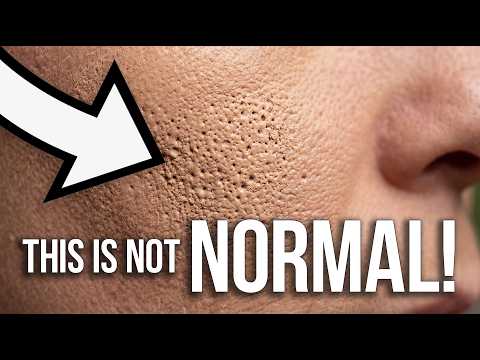 IF YOU'RE FOUNDATION LOOKS LIKE THIS - DO THIS!