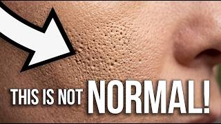 IF YOU'RE FOUNDATION LOOKS LIKE THIS - DO THIS!