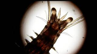 Marine Worm Annelida Through A Microscope.