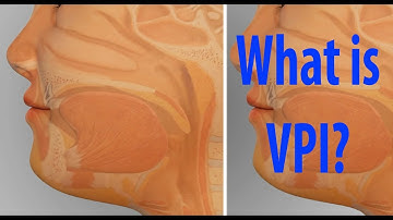 What is VPI (Velopharyngeal Insufficiency)?