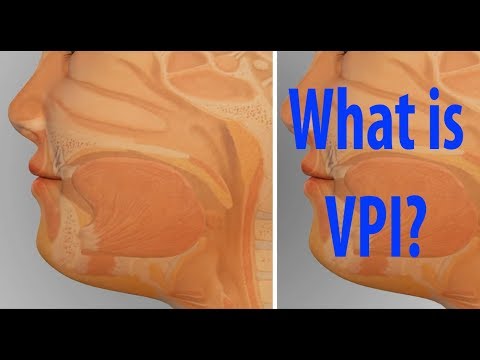Video: Wat is ingesluit by VPI?