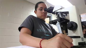 Blood Film, WBC Differential, Platelet Estimation,  RBC morphology