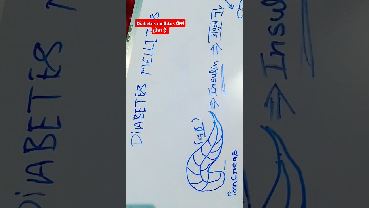 how to cause diabetes mellitus #diabetes