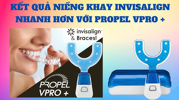 Thiết bị tăng tốc khay Invisalign | Tt niềng răng quốc tế Diamond
