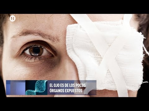 Lesiones comunes en los ojos, ¿cómo evitarlas o tratarlas?