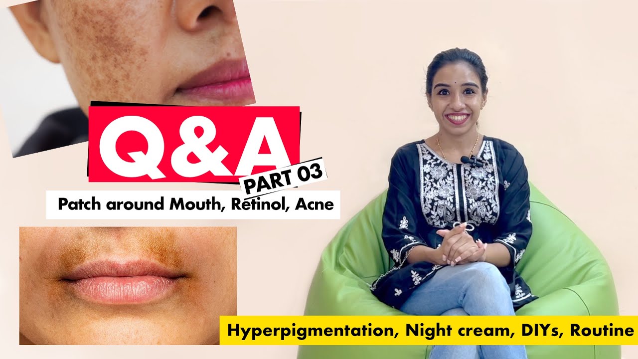 Q&A Part03, Patch around mouth, Retinol, Acne, Night Cream, DIYs