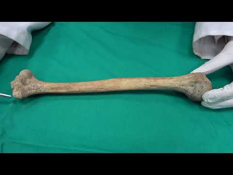 Anatomi Kemikler-Üst Ekstremite Kemikleri- Os Humerus Anatomisi (kemikler anatomi)