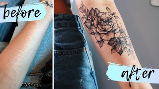 getting a tattoo over my self harm scars | Peony Floral Tattoo