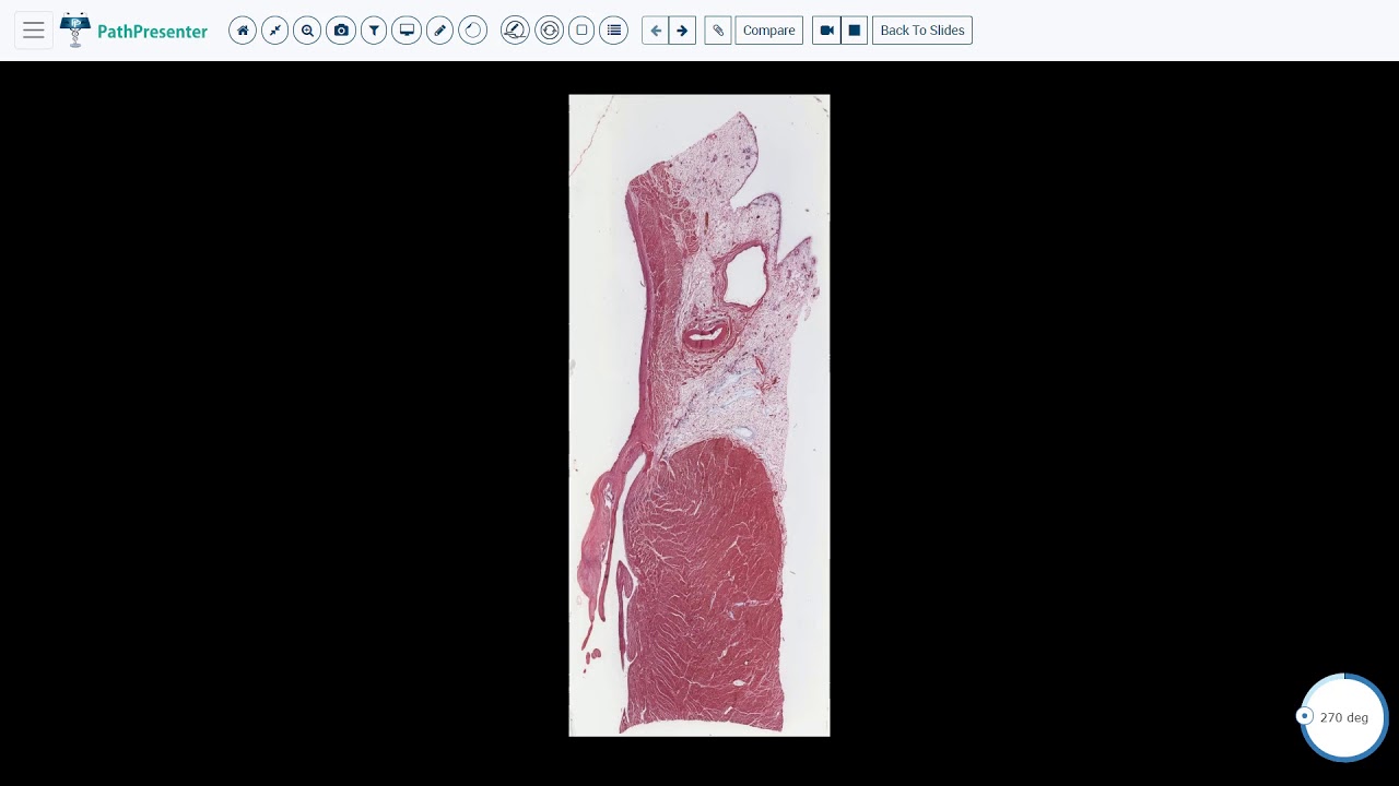 Normal Cardiac Valve Histology 6 min YouTube