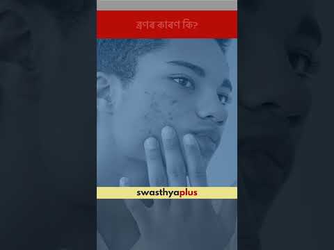 ব্ৰণৰ কাৰণ কি? | What causes Acne? | Dr Sharadi Shreemoyee | #Shorts