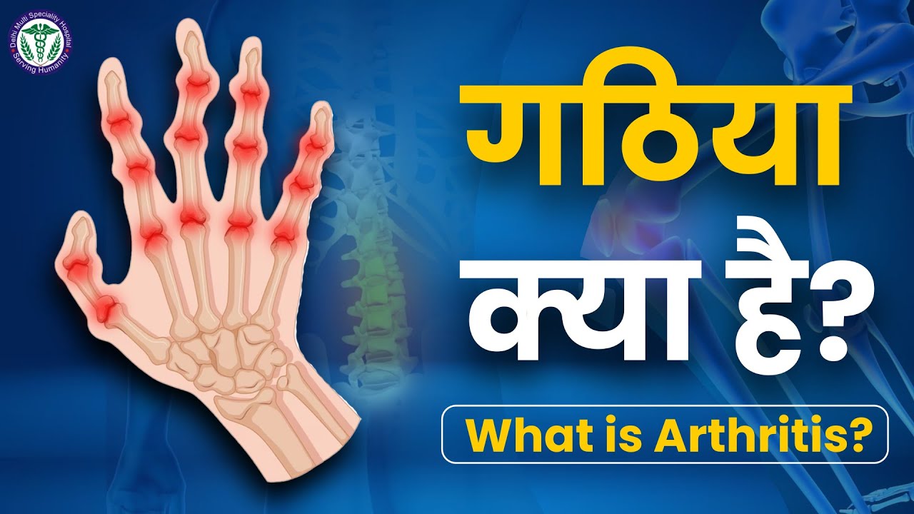 गठिया क्या है? What is Arthritis? Understanding Arthritis DELHI