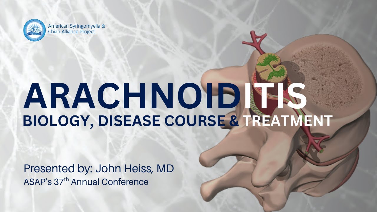 Обновление информации о биологии, течении заболевания и лечении арахноидита — Джон Хейсс, доктор ...