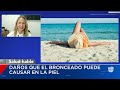 Cámaras de bronceado aumentan hasta 15 veces el riesgo de desarrollar melanoma