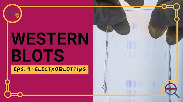 Western Blot: Introduction to Electroblotting