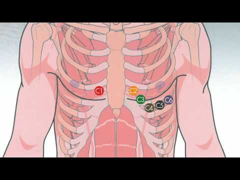 True Integration: Demonstrating an easy-to-use ECG integrated device for GPs