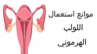 موانع استعمال اللولب الهرموني