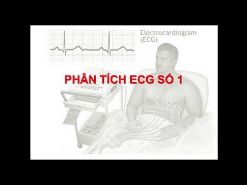ECG 1 Nhồi máu cơ tim cấp thành dưới