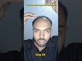 Day 26 | 180 days hair regrowth challenge #manmatters #lifeisbutadream #hairstyle