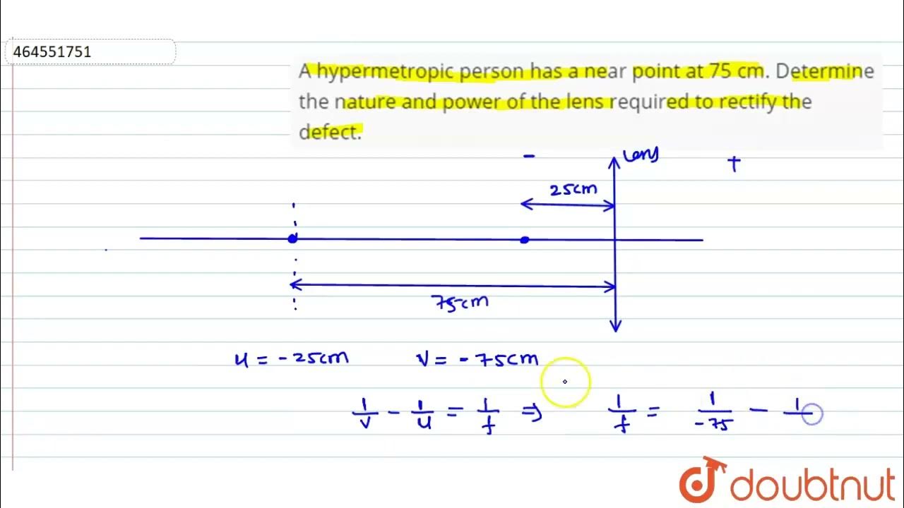 A hypermetropic person has a near point at 75 cm. Determine the nature