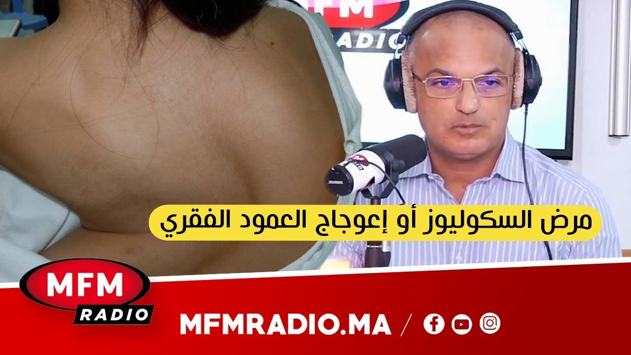 السكوليوز أو اعوجاج العمود الفقري الأسباب والعلاج مع الدكتور بوشعيب يوسري اخصائي جراحة الأطفال