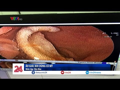 Video Kinh dị: Ảo giác cỏ Mỹ, nam sinh cắn đứt tai bạn nuốt... - youtube