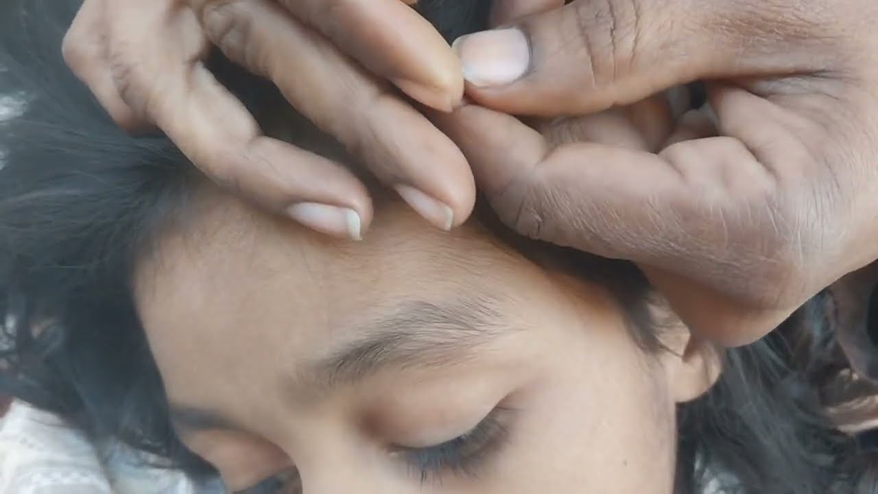 Nitpicking ASMR vvideo 233          #kuto #piolho #nitpicking #asmr  ( few noises in background )