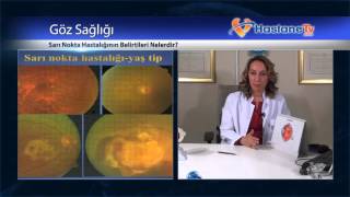Sarı Nokta Hastalığının Belirtileri Nelerdir?