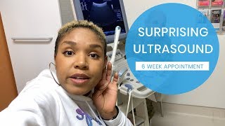 FIRST ULTRASOUND APPOINTMENT || 6 WEEKS PREGNANT || Rainbow Baby #1