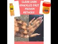 how to clear stubborn dark knuckles|proven methods to get rid of dark knuckles