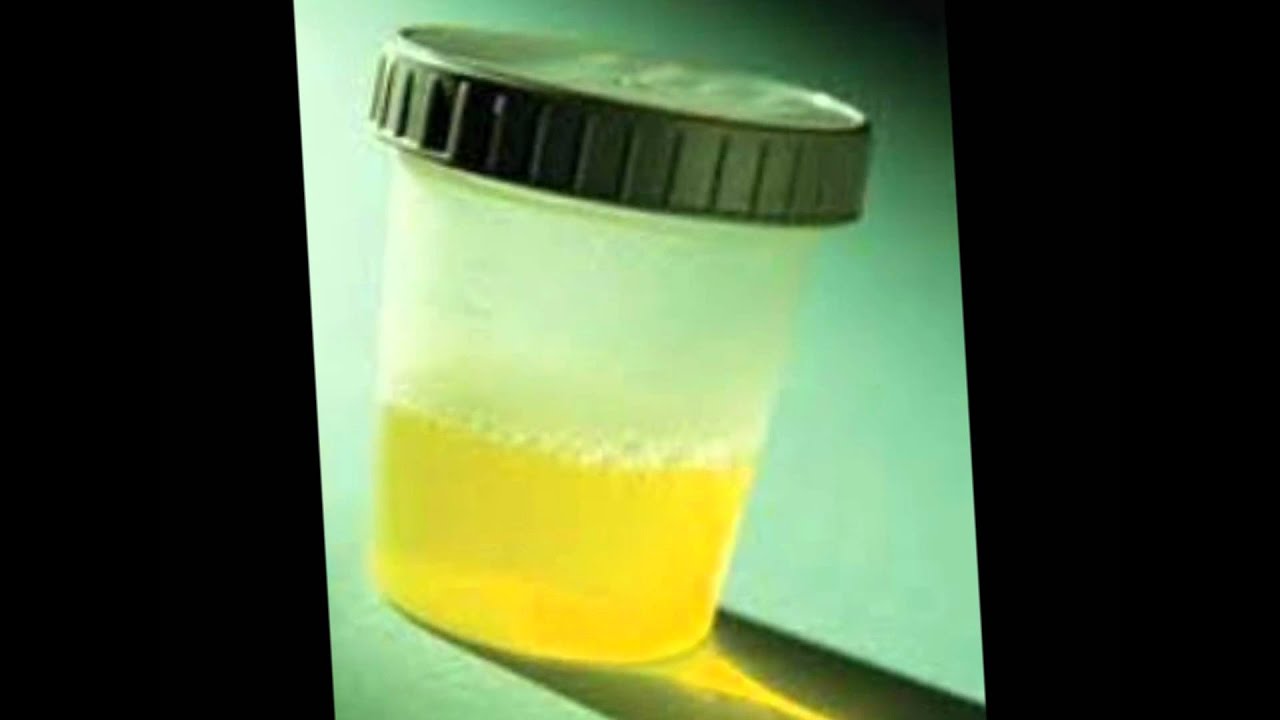 toma de muestra de orina youtube