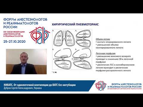 От однолегочной вентиляции до ВАТС без интубации Дубров С.А.