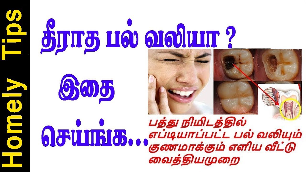 பத்தே நிமிடத்தில் பல் வலி குணமாக இயற்கை மருந்து/How to get rid of Tooth