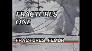 Canadian Forces - Combat First Aid Training: Fractures 1