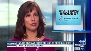 Eczema's Potential Link to Allergies