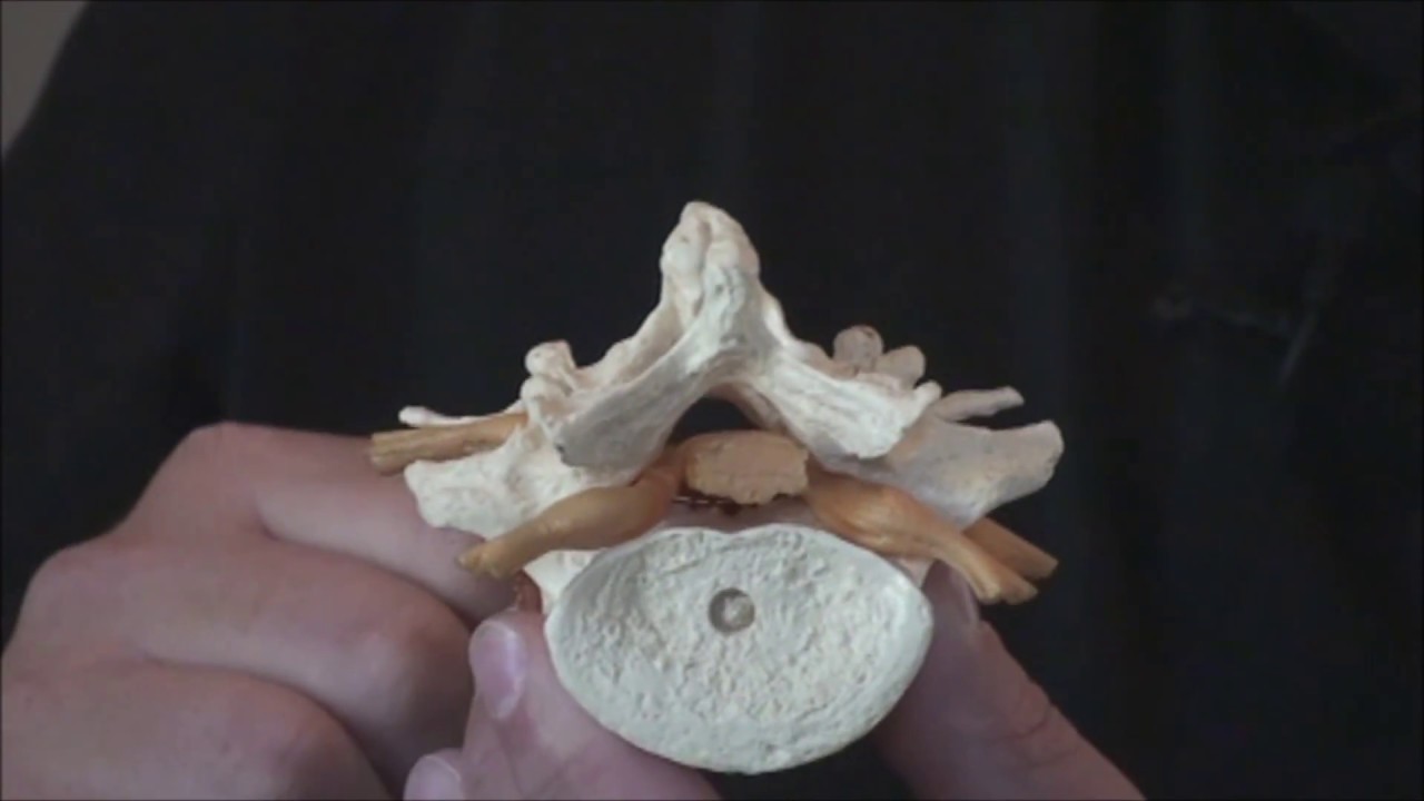 What Is Spinal Stenosis