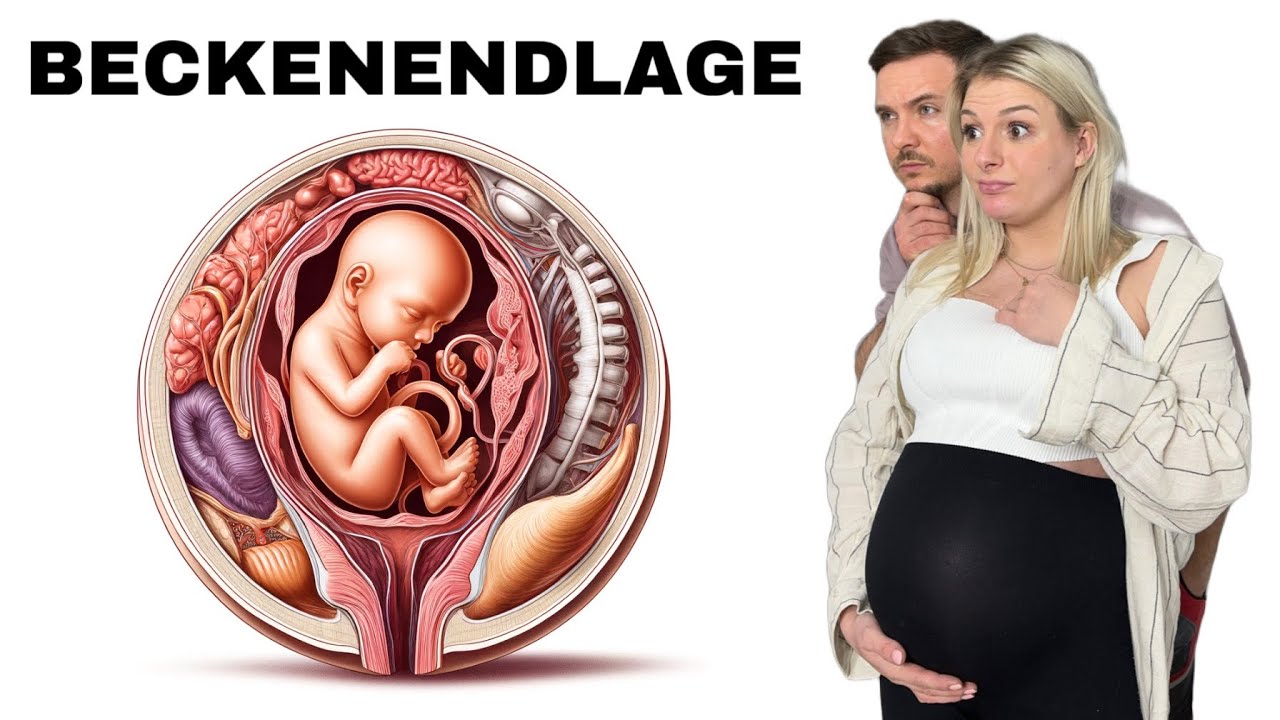 Beckenendlage - Äußere Drehung oder Kaiserschnitt? | FitnessCouple Reaktion