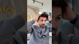 Saç Ekimi Öncesi Sonrası l Hair Transplant Before After #hairtransplant #trapiantocapelli #saçekimi