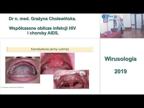 Współczesne oblicze infekcji HIV i choroby AIDS