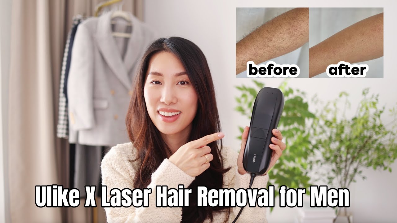 Ulike X Laser Hair Removal for Men Review |The Perfect Self-Care