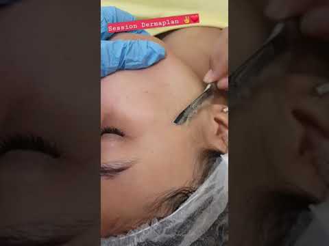 الديرما بلانينج تفتيح البشره