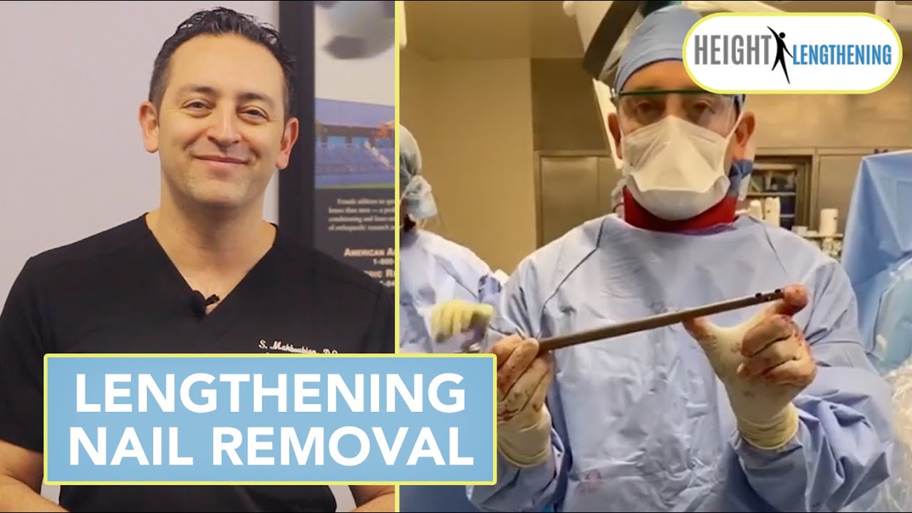 Limb Lengthening Nail Removal Process Height Lengthening YouTube