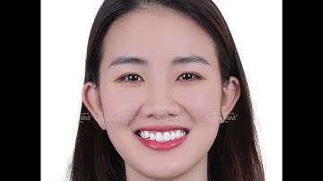 THẦN THÁI TỰ TIN, NỤ CƯỜI TOẢ SÁNG CÙNG SAN DENTIST