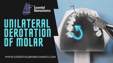 Unilateral derotation of molar with TPA | Essential Biomechanics