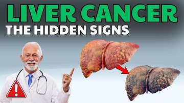 Warning Signs That Hepatitis Is Turning into Liver Cancer